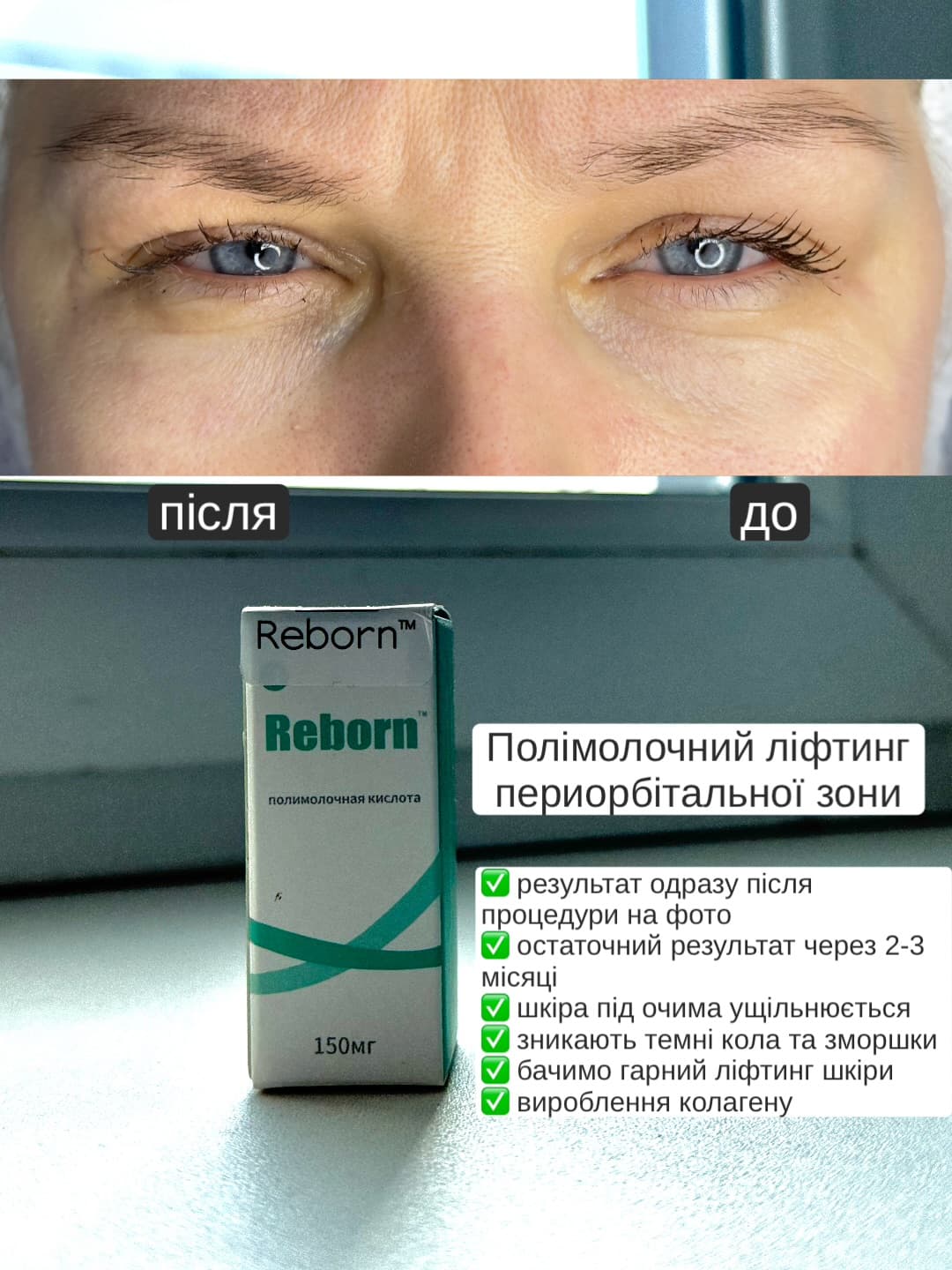 Лікар косметолог Анастасія Касенко | Мерефа | Харків — робота 10
